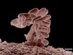 Dangerous strains of E. coli seem to live longer