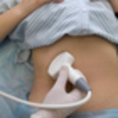 Number of abortions in 2012 lowest since 1995